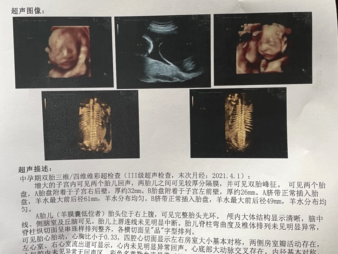 甲醛對胎兒的傷害