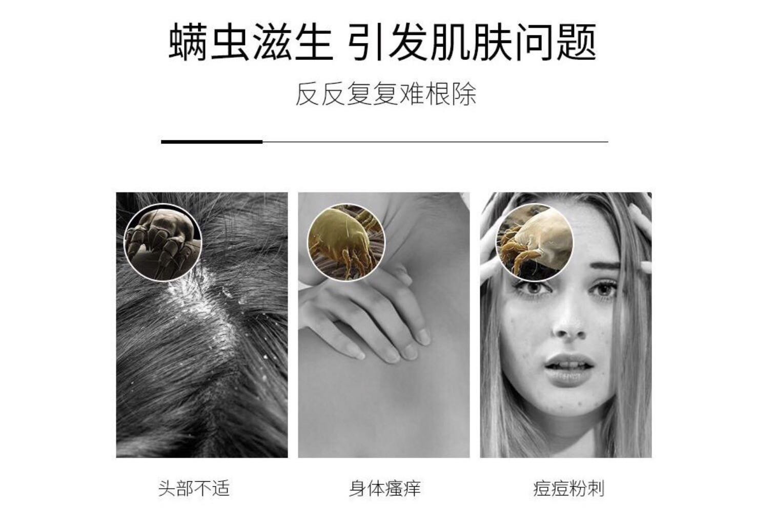 螨蟲(chóng)