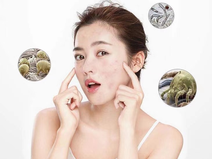 皮膚經(jīng)常過敏，長(zhǎng)痘？警惕是新房裝修原因！