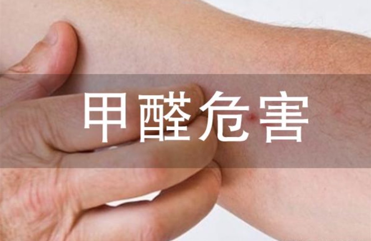 處于甲醛農(nóng)濃度超標(biāo)的環(huán)境會對皮膚造成刺激