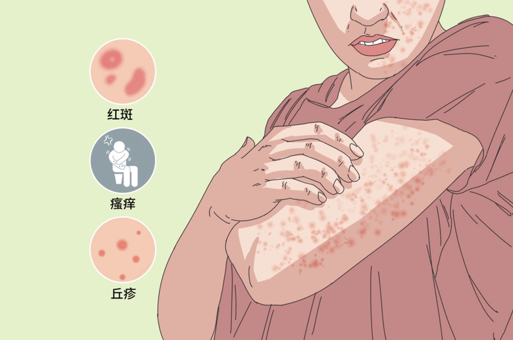 皮膚疾病，不僅要治療，更要預(yù)防！